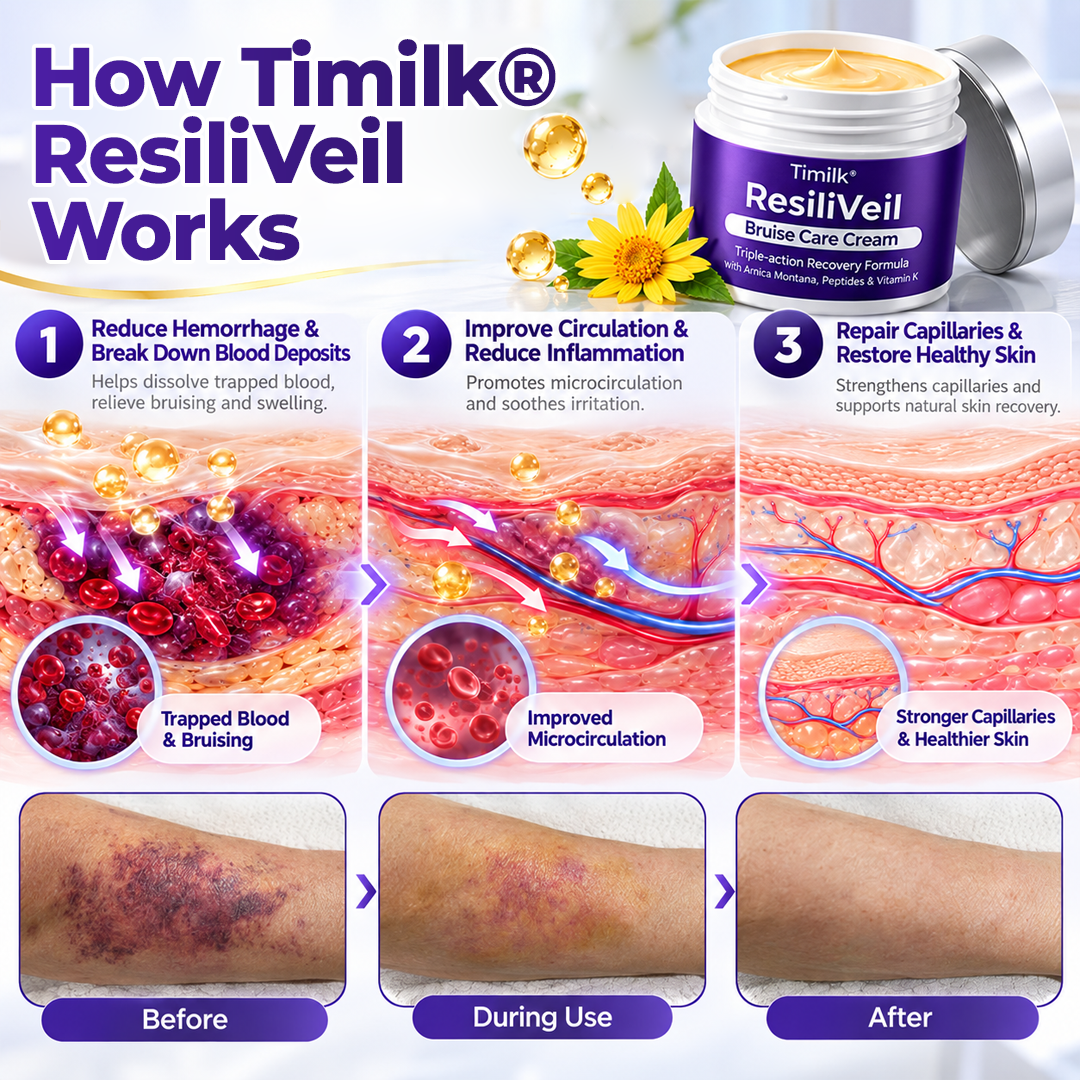 Timilk® ResiliVeil Bruise Care Cream