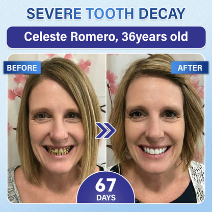 (NEW)Ceoerty® Tooth & Gum Repair Fast-Dissolving Microneedle Patch