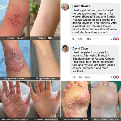Biancat® Squalane Barrier Rescue Cream