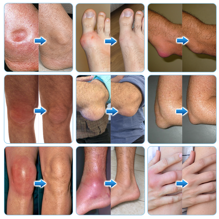 Ceoerty® JointVive Advanced Recovery Roll-On
