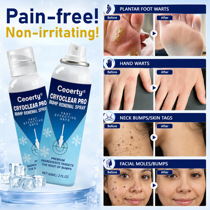 Ceoerty® CryoClear Pro Bump Renewal Spray