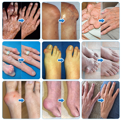 Ceoerty® JointVive Advanced Recovery Roll-On