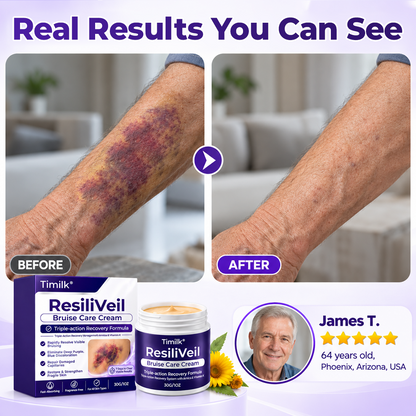 Timilk® ResiliVeil Bruise Care Cream