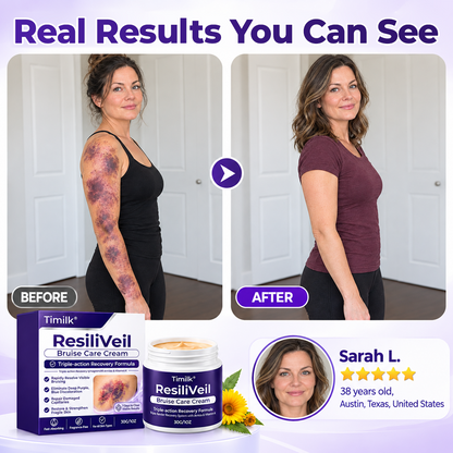 Timilk® ResiliVeil Bruise Care Cream