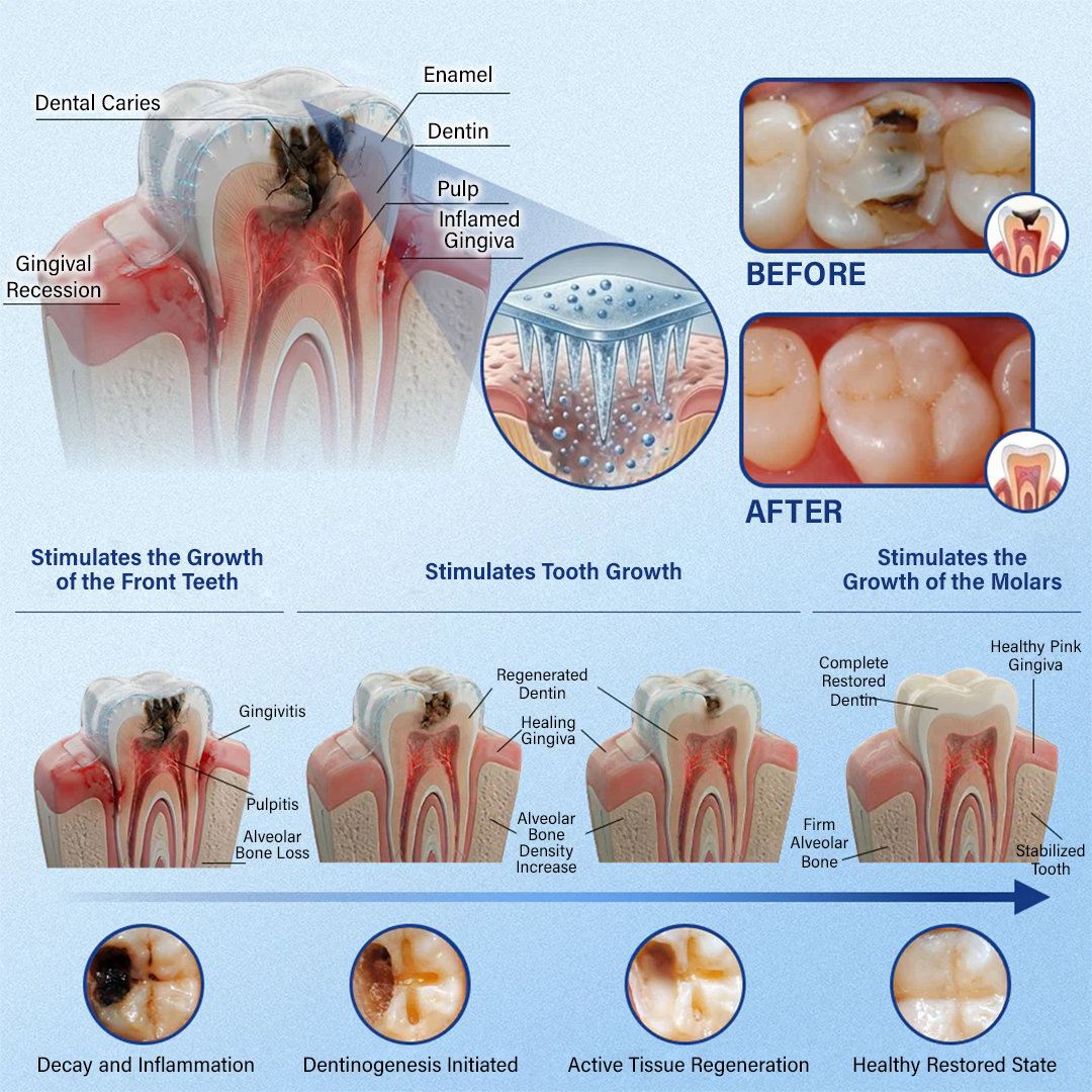 (NEW)Ceoerty® Tooth & Gum Repair Fast-Dissolving Microneedle Patch
